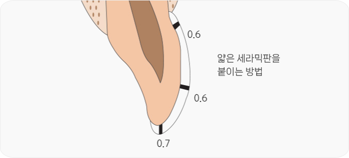 라미네이트